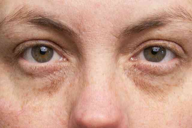Cómo Quitar la suciedad De los Ojos