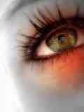 Los Ojos De Las Infecciones Por Estafilococos