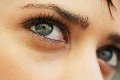 Cómo Blanquear la Esclerótica de los Ojos