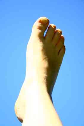 ¿Cuáles Son los Signos, los Síntomas de la Gota en el Dedo gordo del pie?