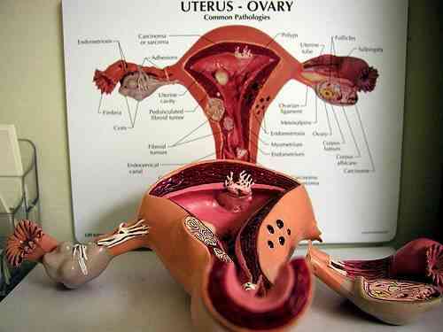 ¿Cuáles Son los Efectos Secundarios de la Ablación Endometrial?