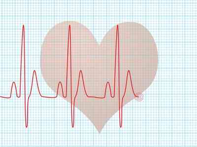 Cómo Prepararse para un Ecocardiograma