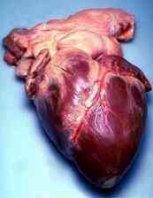¿Cuáles Son las Causas de un Agrandamiento del Corazón?