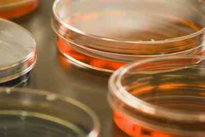 Cómo Esterilizar los Platos Petri