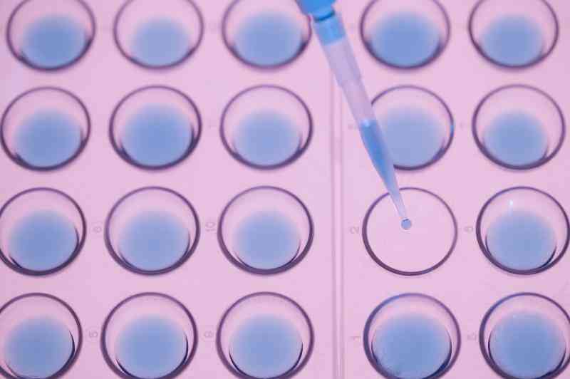 Cómo Crecer de E. Coli en una placa de Petri