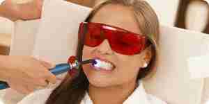 Blanquear los dientes: whiting métodos y tratamientos