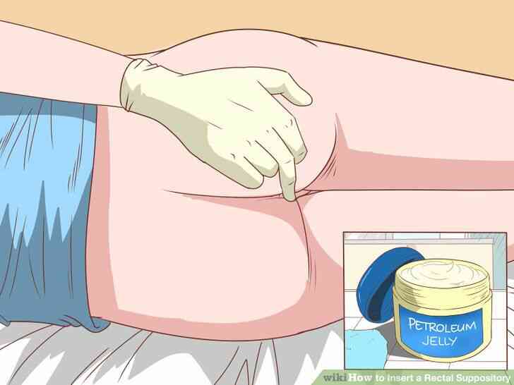 Imagen titulada Insertar un Supositorio Rectal Paso 6