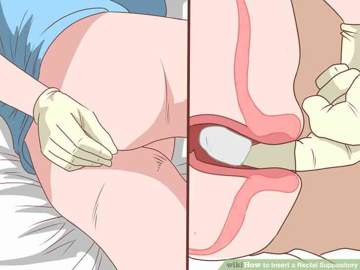 Imagen titulada Insertar un Supositorio Rectal Paso 8