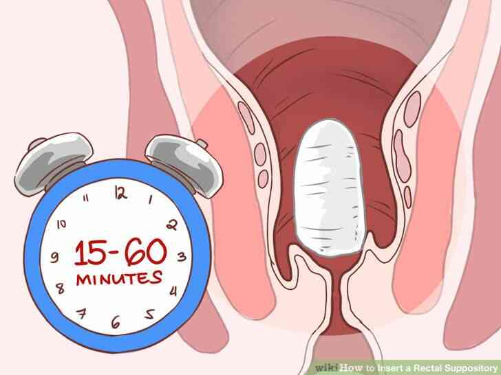 Imagen titulada Insertar un Supositorio Rectal Paso 10