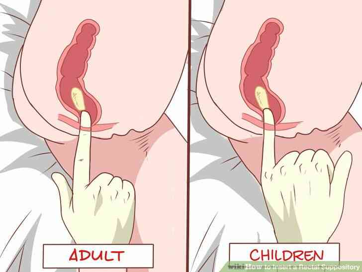 Imagen titulada Insertar un Supositorio Rectal Paso 14