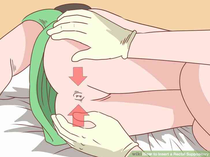 Imagen titulada Insertar un Supositorio Rectal Paso 15