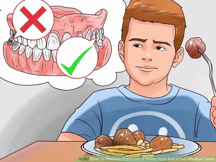Imagen titulada Quitar la Comida de los Agujeros de Extraídos los Dientes de la Sabiduría Paso 12